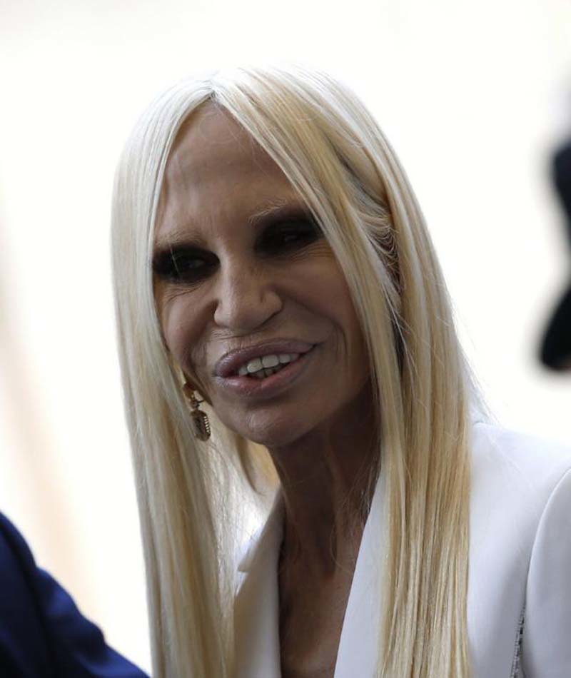 <p class="Normal" style="text-align:justify;"> Do quá lạm dụng phẫu thuật thẩm mỹ nên gương mặt của nhà thiết kế Donatella Versace ngày càng bị biến dạng vô cùng xấu xí.</p>