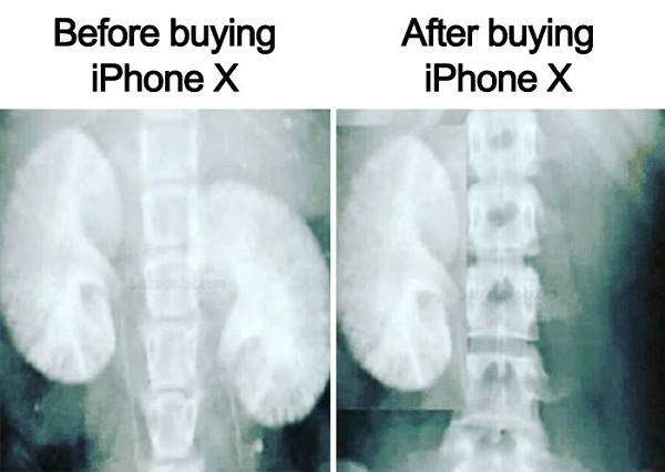 <p> Bán thận để mua iPhone. </p>