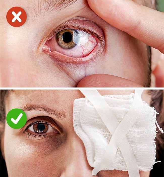 <p class="Normal"> <strong>6. Không dụi tay khi có thứ gì chui vào mắt</strong></p> <p class="Normal"> Nếu dùng tay dụi, niêm mạc mắt sẽ bị thương tổn. Vì thế, hãy nhắm mắt lại và dùng băng bạc để che. Nếu bị bắn hóa chất vào mắt, bạn phải đi rửa mắt ngay lập tức.</p>