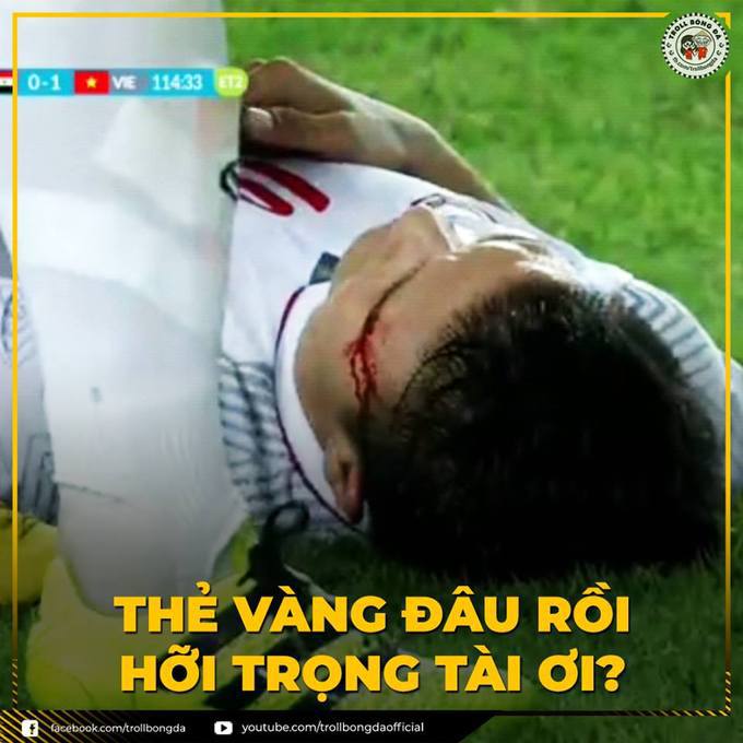 <div style="text-align:justify;"> Chiến thắng của đội tuyển Việt Nam được đánh đổi bằng máu của tiền vệ Quang Hải.</div>