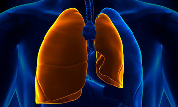 FPT Software phát triển AI giúp phát hiện sớm các bệnh về phổi